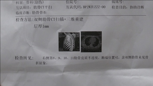 摔断四根肋骨！那一刻，他得多疼啊……